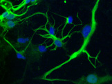 Astrocytes